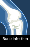 Bone Infection