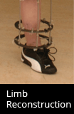 Limb Reconstruction